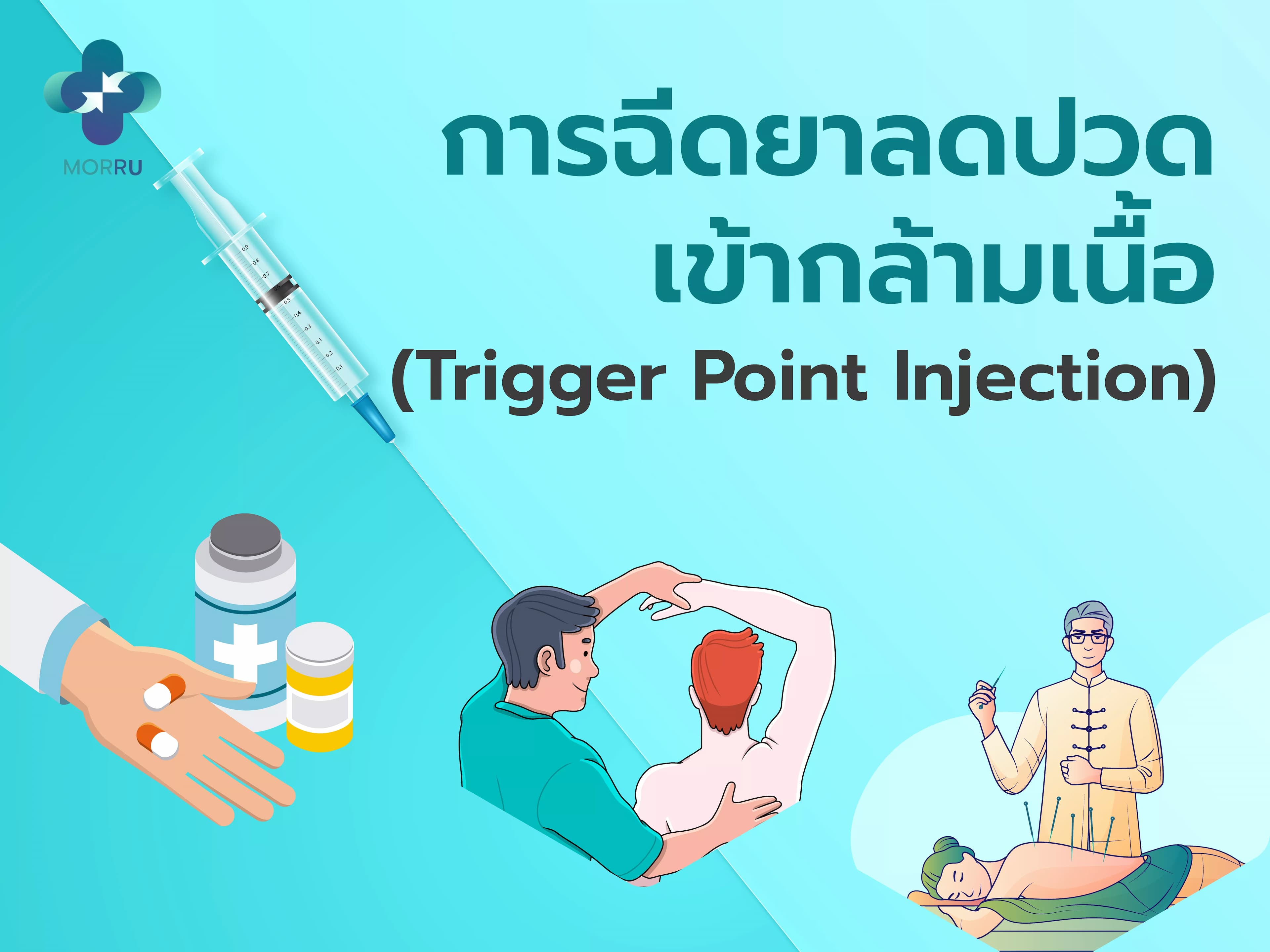 การฉีดยาลดปวดเข้ากล้ามเนื้อ (trigger point injection) 