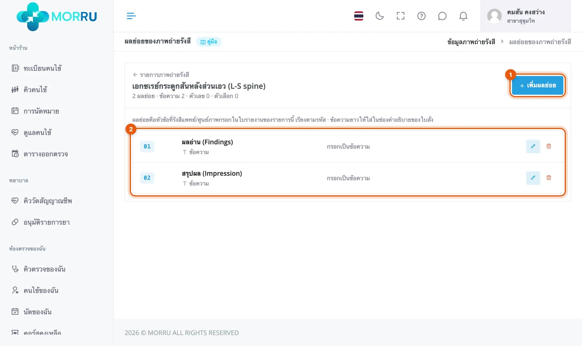 หน้าผลย่อยของเอกซเรย์กระดูกสันหลังส่วนเอว 01 ผลอ่าน (Findings) 02 สรุปผล (Impression) แบบข้อความ