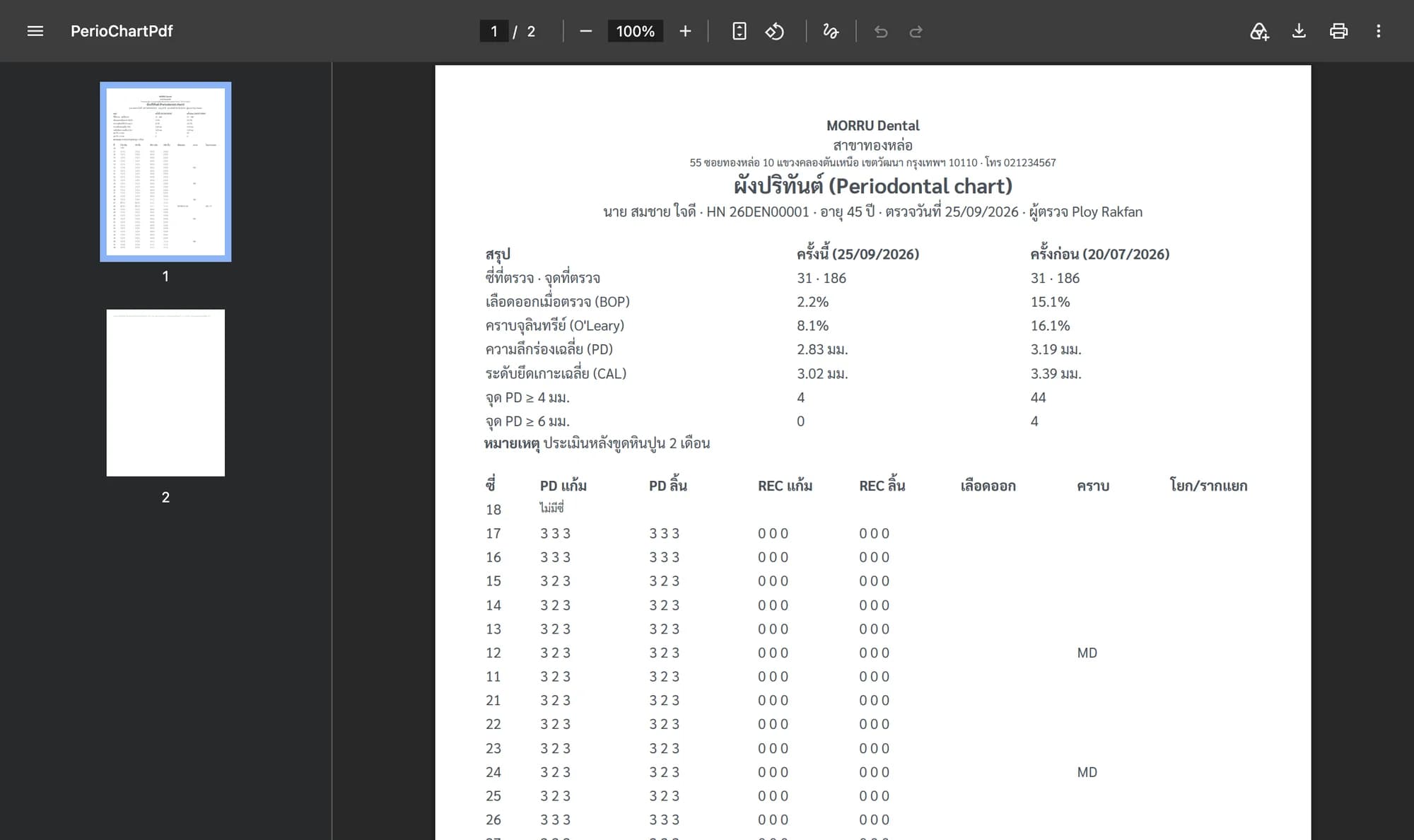 PDF ผังปริทันต์ หัวคลินิก ชื่อคนไข้ ตารางสรุปครั้งนี้เทียบครั้งก่อน และตารางค่ารายซี่